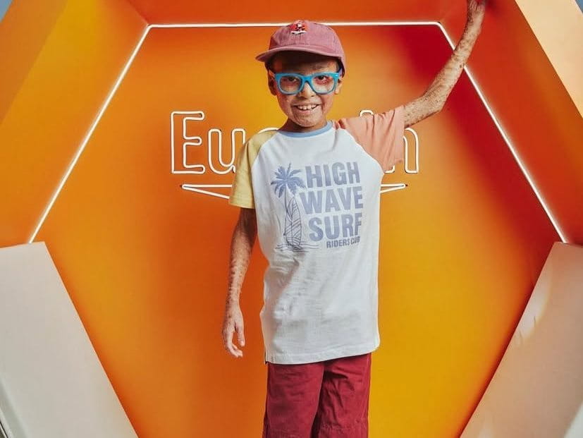 A boy standing in an orange exhibition cube branded Eucerin, raising one arm, with visible skin differences on the arm and legs.