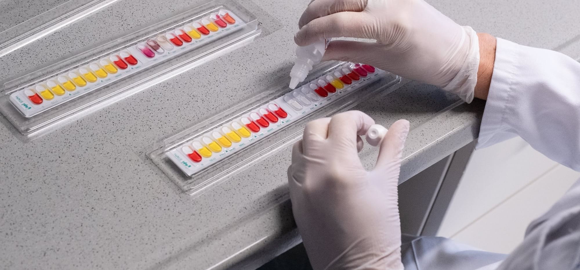 Gloved hands arranging pH indicator strips on a laboratory bench, preparing samples for chemical analysis.